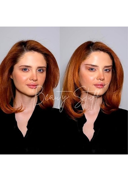 Stuff Lift ‘em Up Yüz Germe Bandı, Ameliyatsız Yüz Germe, Suya Dayanıklı Kaş Kaldırma Bantları, Lastikli Yüz Gerdirme Bantları, Made In Usa, 20 Adet (Bej Lastikli) indirimleri