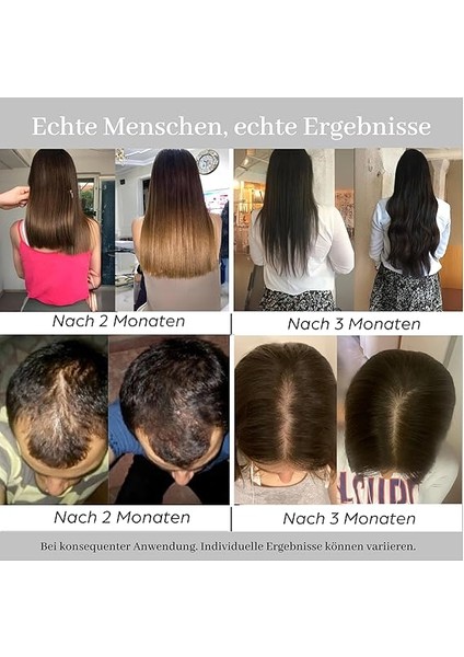 Haır Yoğunlaşma Nane Saç Oluşumuna Yardımcı Saç Serumu Dökülme Karşıtı - Biotin, Keratin, Peptid, Procapil Saç Vitamini Kompleksi, Diamond Hair fiyatları