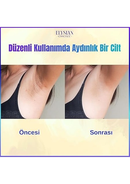 Essence Cilt Beyazlatıcı | Kararma Giderici Krem 3'lü Set - Genital Bölge, Koltuk Altı, Bikini Bölgesi, Dirsek ve Vücut 100 ml indirimleri