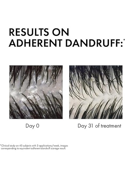 Dercos Anti-Dandruff Kepek Karşıtı Bakım Şampuanı - Kuru Saçlar (390 Ml) fiyatları