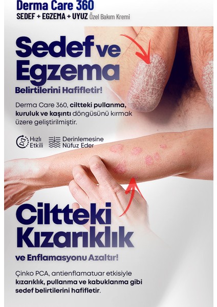 Derma Care 360 - Sedef, Egzema ve Atopik Dermatit Ciltler Için Özel Onarıcı Bakım Kremi fırsatları
