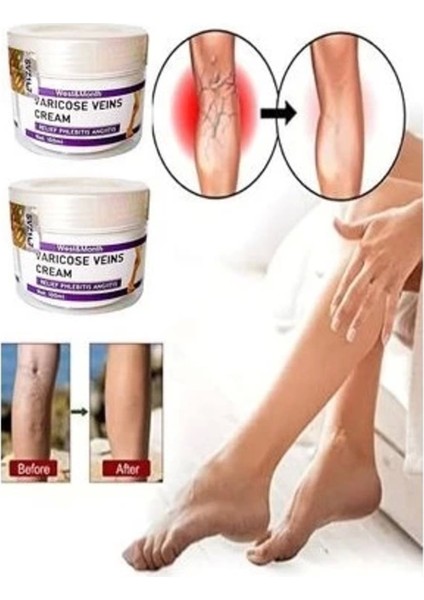 Süper Varicose And Spider Veins Soothing Leg Cream Bacak Bakım Kremi 100 ml x 2 Adet