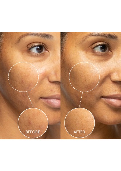 Arbutin & Hyaluronic Asit Leke Karşıtı Bakım Krem 50 ml