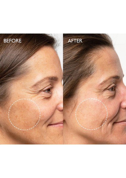 Arbutin & Hyaluronic Asit Leke Karşıtı Bakım Krem 50 ml