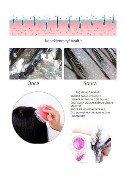 Mawrond, Silikon Başlıklı ve Sivri Uçlu Saç Derisine, Peeling, Masaj Yapan, Yumuşak Banyo,duş Fırçası, Silikon, Saç Derisi Temizleme Başlığı (2 Adet) modelleri