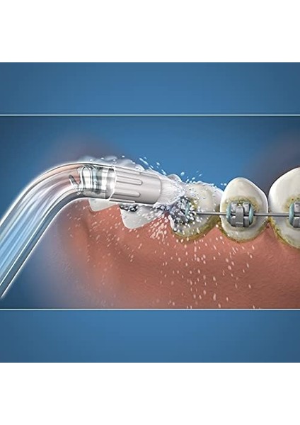 Waterpik Beyazlatıcı Ortodontik Başlık, Diş Tellerinin Temizliği Için Yedek Başlık, Protez, 2&apos;li Paket (Wod-2e)