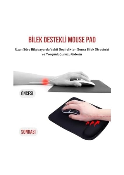 Kare Bilek Destekli Konfor Kaymaz Ergonomik Mouse Pad Siyah Siyah