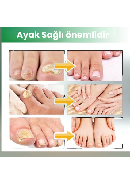 100 ml Ayak Bakım Spreyi – Hızlı Etkili Ayak ve Tırnak Spreyi, Etkili Ayak Kokusu Kontrolü, Ayakkabı ve Çorapları Taze ve Kuru Tutar, Kolay Uygulanır, Ayak Hijyenini Iyileştirir fırsatları