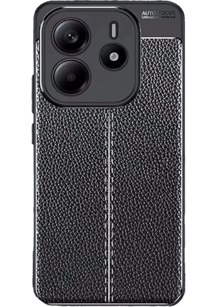 Xiaomi Redmi Note 14 4g Kılıf Auto Focus Kapak - Siyah