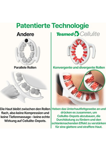 Selülit Masaj Aleti – Convergent & Divergent Roller Teknolojisi | Made In Italy modelleri