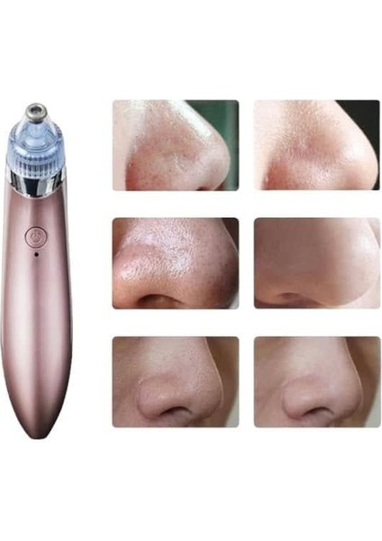 Siyah Nokta Cihazı - ME001W-51ODX5