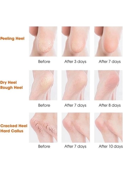 Silikon Topuk Nemlendirici Çorap fiyatları