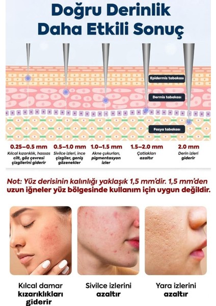 120 Titanyum Iğneli Ayarlanabilir Iğne Ölçülü (0.25-2.0mm) Dermastamp Derma Stamp Dermaroller Roller indirimleri