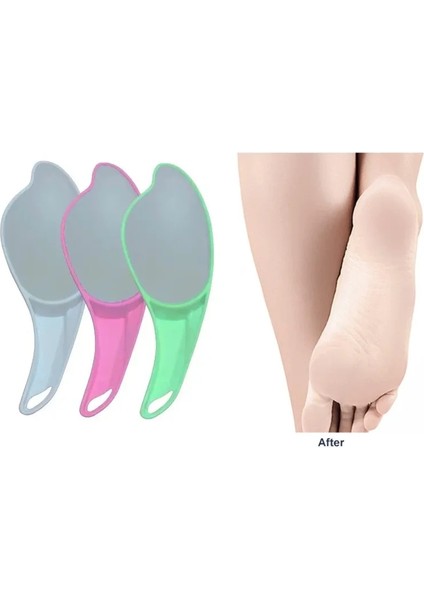 Egonex Topuk Törpüsü ve Kıl Alma Aparat