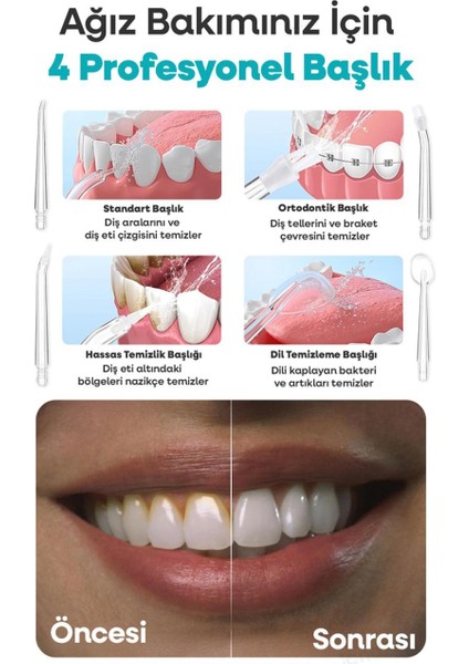 Şarjlı Taşınabilir Ağız Duşu, 3 Mod, 4 Başlık, Diş Arası Temizleyici Seyahat Dostu modelleri