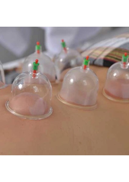 Hacamat Kupa Seti 6 Adet fiyatları