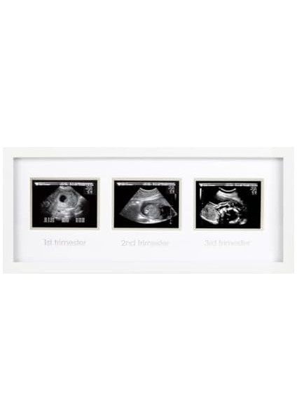 87038 Trimester Sonogram Frame Deluxe, Fotoğraf Çerçevesi Için Üç Ultraschallaufnahmen, Beyaz