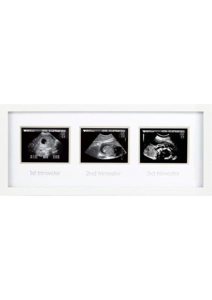 87038 Trimester Sonogram Frame Deluxe, Fotoğraf Çerçevesi Için Üç Ultraschallaufnahmen, Beyaz fiyatları