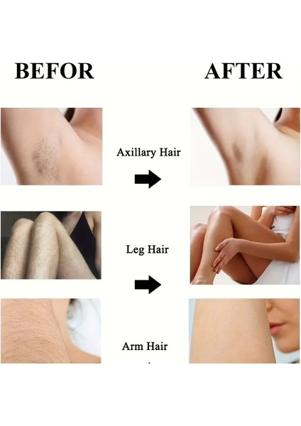 Crystal Eraser Epilasyon Aleti Tüy Silgisi Kristal Epilatör