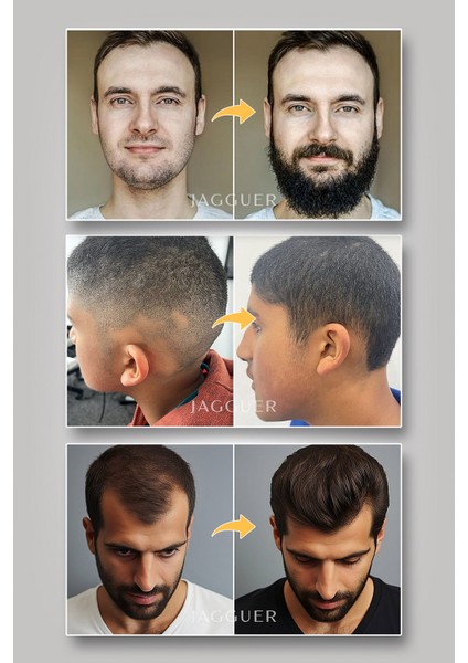 Saç & Sakal Serumu – Saçkıran Sakalkıran Karşıtı Seyreklik Köselik Giderici Biotin Keratin Vitaminli fırsatları