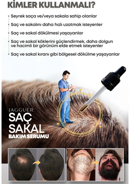 Saç & Sakal Serumu – Saçkıran Sakalkıran Karşıtı Seyreklik Köselik Giderici Biotin Keratin Vitaminli indirimleri