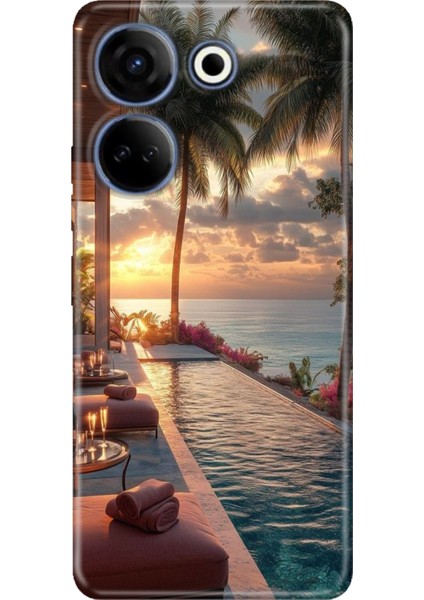 Tecno Camon 20 Kılıf Desenli Baskılı Tpu Rubber Kapak Zengin Tatili