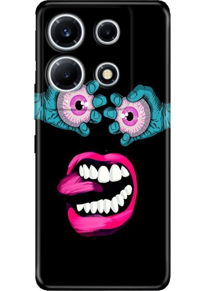Infinix Note 30 Vip Kılıf Desenli Baskılı Tpu Rubber Kapak Angry