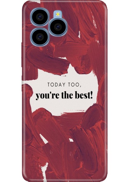 Omix X6 Kılıf Desenli Baskılı Tpu Rubber Kapak Today