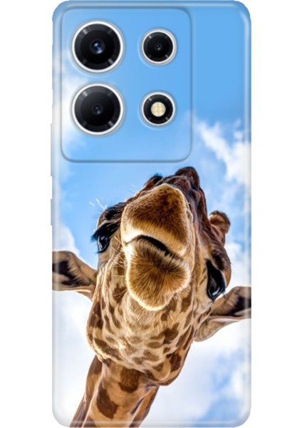 Infinix Note 30 Vip Kılıf Desenli Baskılı Tpu Rubber Kapak Öpücük