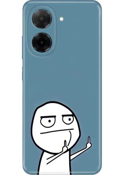 Xiaomi Redmi A5 Kılıf Desenli Baskılı Tpu Rubber Kapak Trollcük