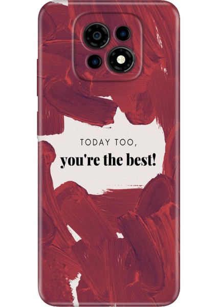 Casper Via M30 Kılıf Desenli Baskılı Tpu Rubber Kapak Today