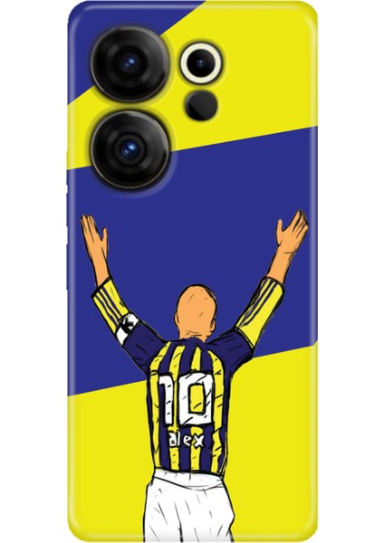 Tecno Camon 20 Premier 5g Kılıf Desenli Baskılı Tpu Rubber Kapak Alex