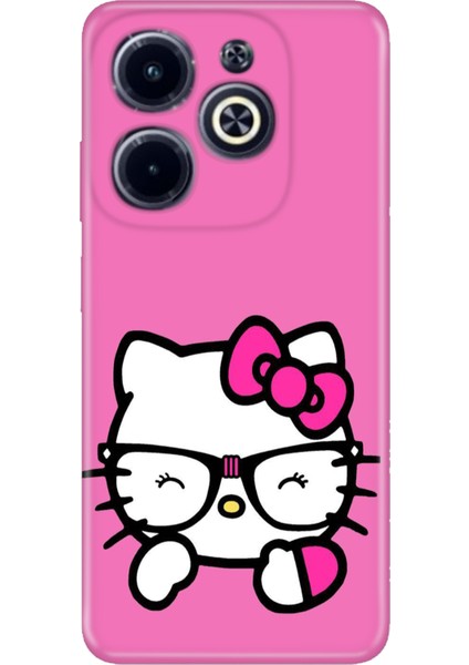 Infinix Hot 40 Pro Kılıf Desenli Baskılı Tpu Rubber Kapak Kitty/go