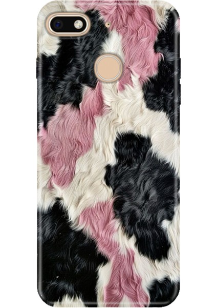 General Mobile Gm 8 Go Kılıf Desenli Baskılı Tpu Rubber Kapak Kıvırcık Kürk