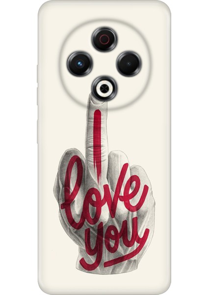 Tecno Spark 30 Kılıf Desenli Baskılı Tpu Rubber Kapak I Love You