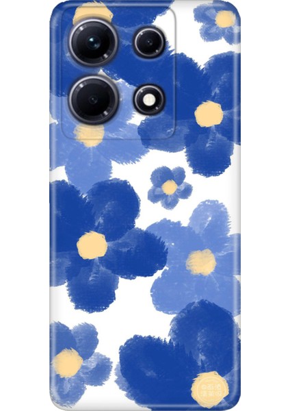 Infinix Note 30 Pro Kılıf Desenli Baskılı Tpu Rubber Kapak Blue Orgin