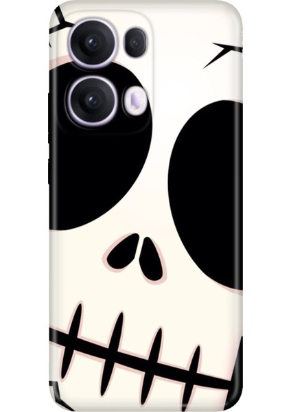 Oppo Reno 13 Pro Kılıf Desenli Baskılı Tpu Rubber Kapak İSKELET-444