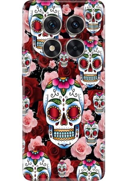 Xiaomi Redmi Note 14 Pro 5g Kılıf Desenli Baskılı Tpu Rubber Kapak Kabile