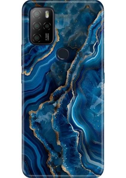 Omix X300 - X500 Kılıf Desenli Baskılı Tpu Rubber Kapak Dark Ametist