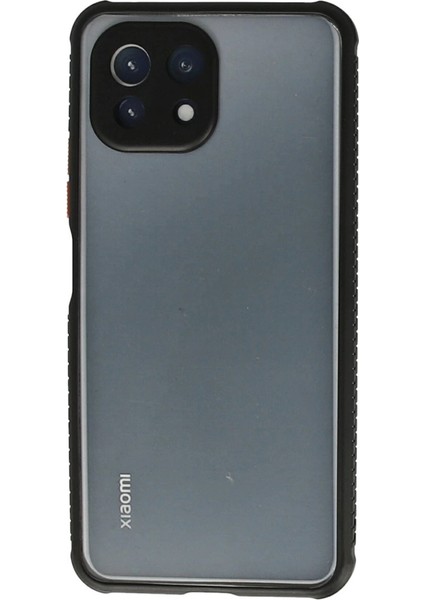 Xiaomi Mi 11 Lite Kılıf Miami Şeffaf Silikon - Siyah