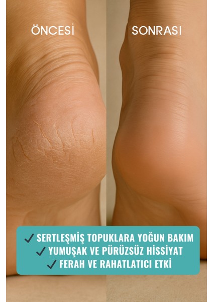 Heél Rescue Çatlak Topuk Yoğun Bakım Balmı 100 Gr, Shea & Çay Ağacı, Doğal Ayak Kremi fiyatları