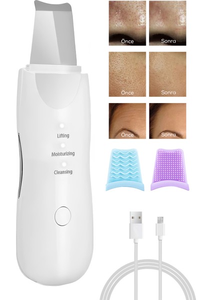 Ultrasonik Yüz Temizleme Cihazı Scrubber | Siyah Nokta Akne Peeling Lifting Nemlendirme Aleti