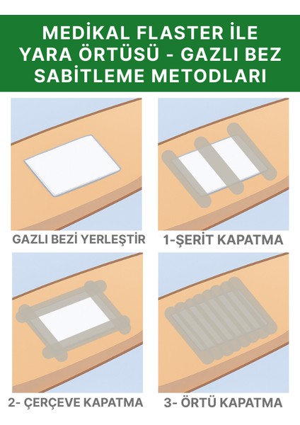 Fix 10 Kutu Kombo Paket- Elastik Sabitleme Bandı Elastik Non-Woven Medikal Flaster
