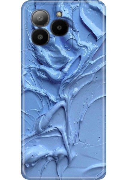 Omix X7 Kılıf Desenli Baskılı Tpu Rubber Kapak Sanatsal