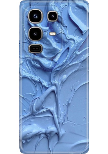 Infinix Note 50 Pro 5g Kılıf Desenli Baskılı Tpu Rubber Kapak Sanatsal