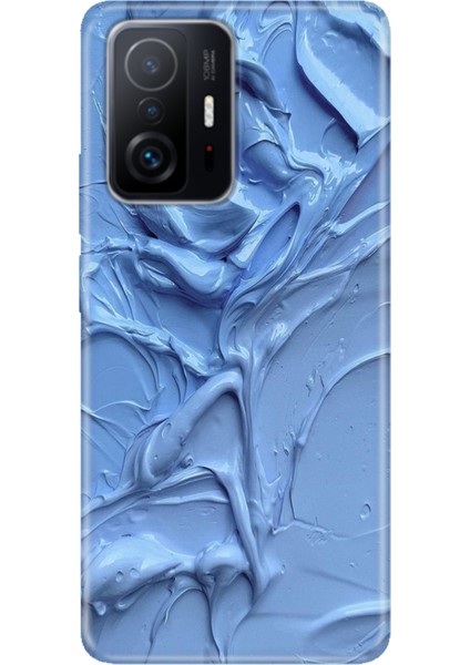 Xiaomi Mi 11T Pro Kılıf Desenli Baskılı Tpu Rubber Kapak Sanatsal