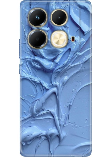 Infinix Note 40 4g Kılıf Desenli Baskılı Tpu Rubber Kapak Sanatsal