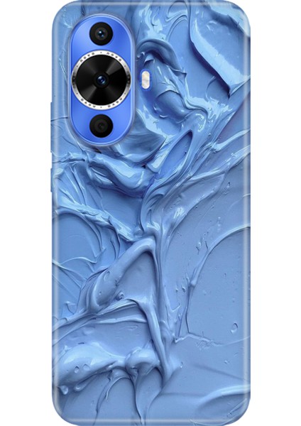 Huawei Nova 12S Kılıf Desenli Baskılı Tpu Rubber Kapak Sanatsal