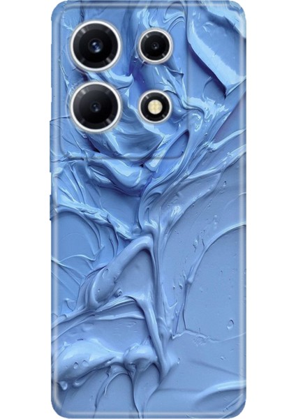 Infinix Note 30 Vip Kılıf Desenli Baskılı Tpu Rubber Kapak Sanatsal