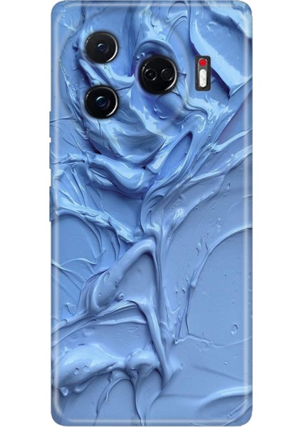 Tecno Camon 30 Pro 5g Kılıf Desenli Baskılı Tpu Rubber Kapak Sanatsal